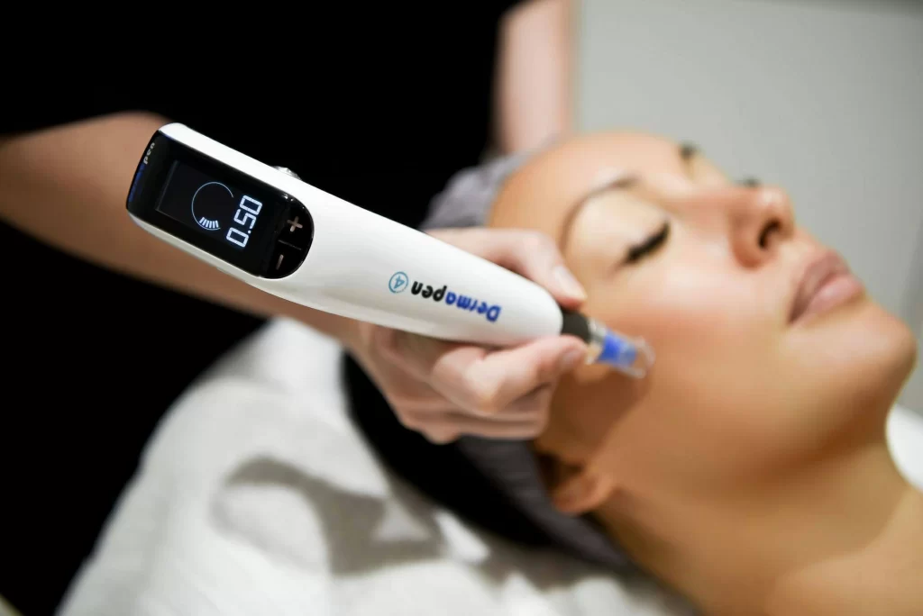 Procedură de microneedling cu dispozitiv dermapen pe fața unei paciente, la Wanderma Clinic