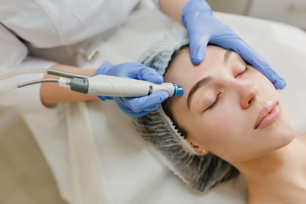 Microneedling Dermapen Craiova