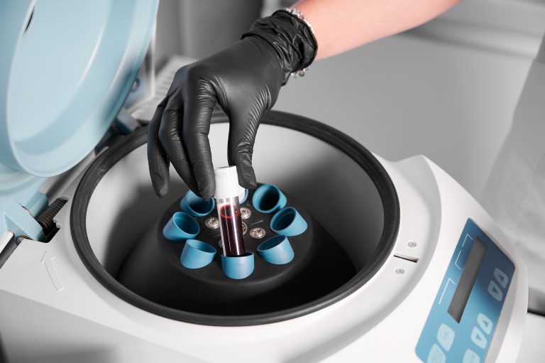 Centrifugă cu eprubete pentru prepararea plasmei PRP la Wanderma Clinic.