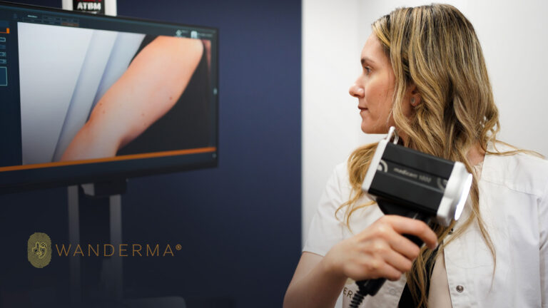 Dermatoscopie digitală totală la Wanderma Clinic