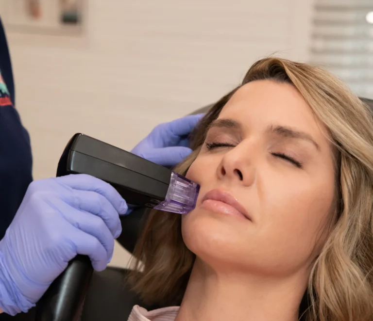 Procedură estetică facială realizată unei paciente la Wanderma Clinic